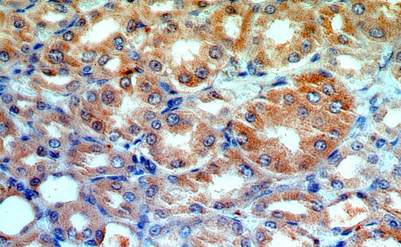 Immunohistochemical of paraffin-embedded human kidney using Catalog No:108316(ATP6V1G3 antibody) at dilution of 1:100 (under 40x lens)