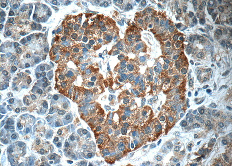 Immunohistochemistry of paraffin-embedded human pancreas tissue slide using Catalog No:109000(CCL18 Antibody) at dilution of 1:50 (under 40x lens)