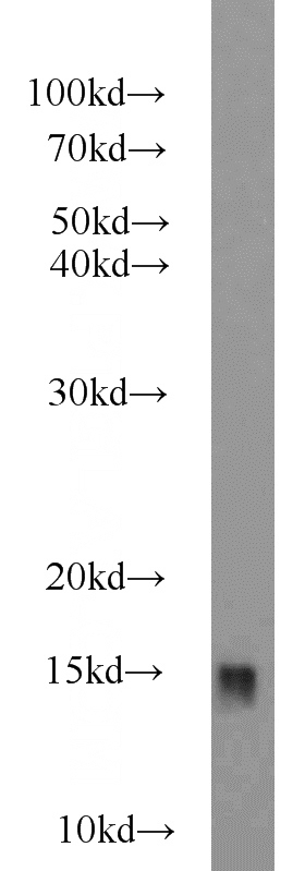 HEK-293 cells were subjected to SDS PAGE followed by western blot with Catalog No:114559(RBP1 antibody) at dilution of 1:1000