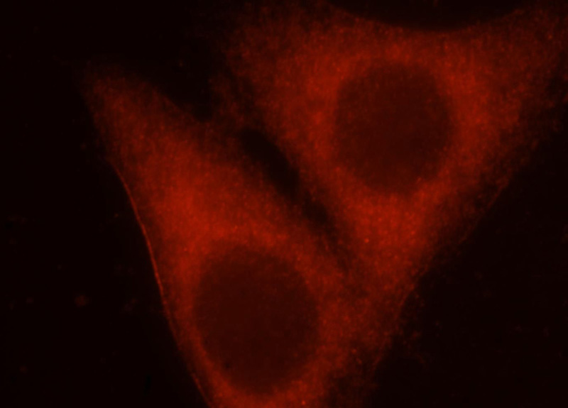 Immunofluorescent analysis of Hela cells, using ARFIP1 antibody Catalog No:108253 at 1:25 dilution and Rhodamine-labeled goat anti-rabbit IgG (red).