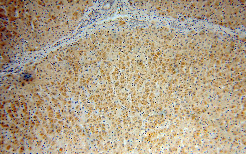 Immunohistochemical of paraffin-embedded human liver using Catalog No:115794(STX17 antibody) at dilution of 1:50 (under 10x lens)