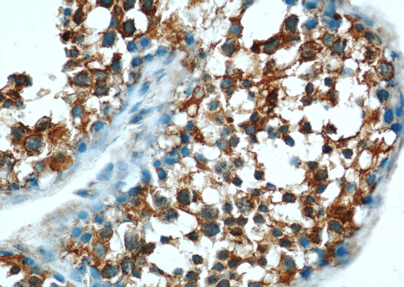 Immunohistochemical of paraffin-embedded human testis using Catalog No:110188(EIF2S2 antibody) at dilution of 1:50 (under 40x lens)
