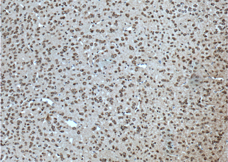 Immunohistochemistry of paraffin-embedded mouse brain tissue slide using Catalog No:108757(CACNA1B Antibody) at dilution of 1:100 (under 10x lens). heat mediated antigen retrieved with Tris-EDTA buffer(pH9).