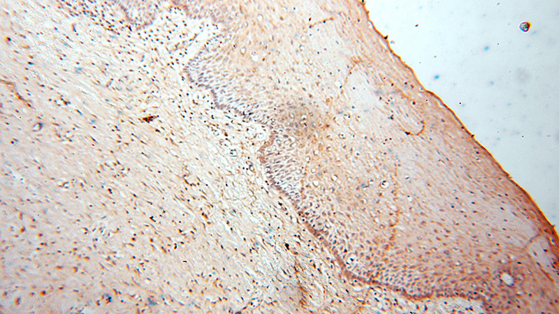 Immunohistochemical of paraffin-embedded human cervix using Catalog No:111187(GSTM4 antibody) at dilution of 1:100 (under 10x lens)