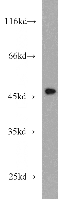 mouse thymus tissue were subjected to SDS PAGE followed by western blot with Catalog No:109794(KRT15 antibody) at dilution of 1:500