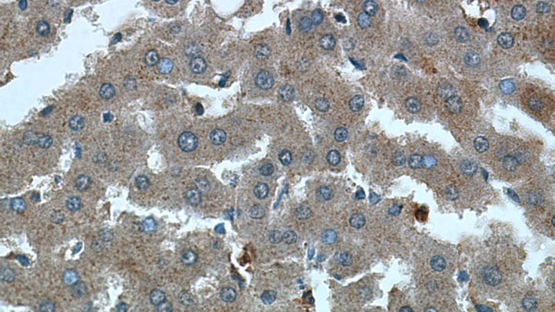 Immunohistochemistry of paraffin-embedded human liver tissue slide using Catalog No:113346(OMA1 Antibody) at dilution of 1:200 (under 40x lens).