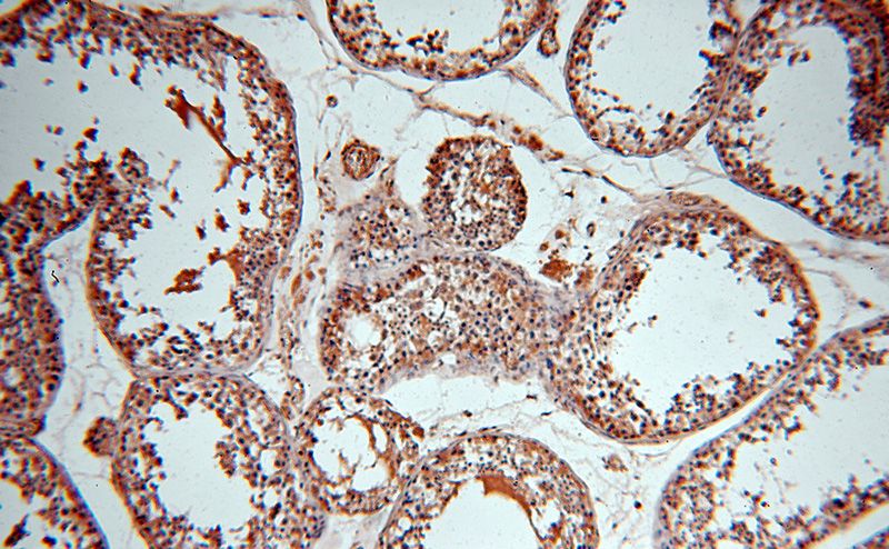 Immunohistochemical of paraffin-embedded human testis using Catalog No:116655(UBN2 antibody) at dilution of 1:50 (under 10x lens)