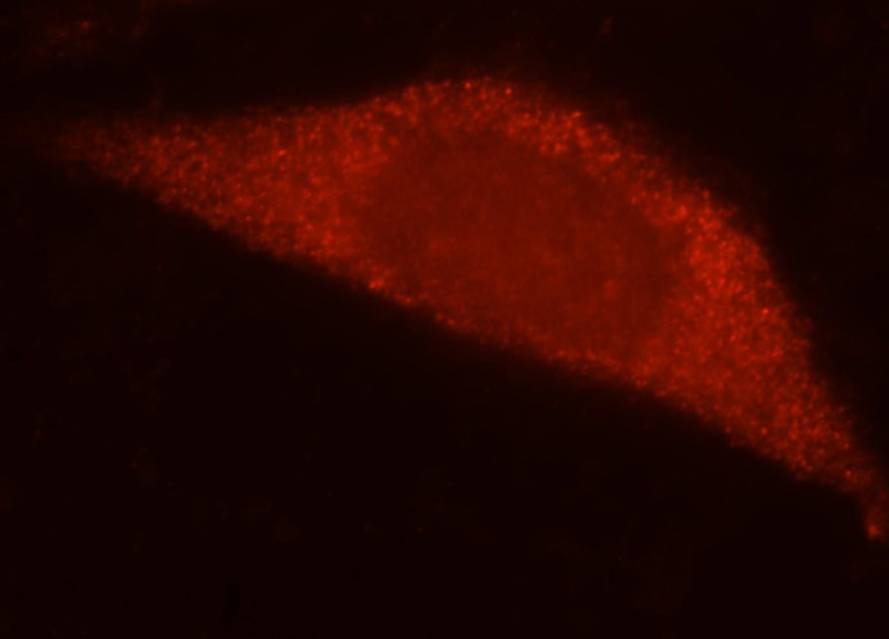 Immunofluorescent analysis of MCF-7 cells, using RPL7L1 antibody Catalog No:114901 at 1:25 dillution and Rhodamine-labeled goat anti-rabbit IgG (red).