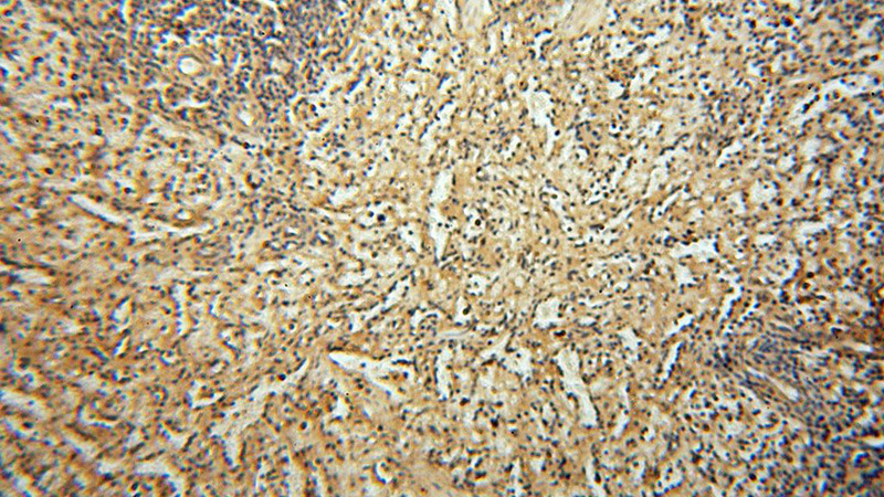 Immunohistochemical of paraffin-embedded human spleen using Catalog No:115760(SYK antibody) at dilution of 1:50 (under 10x lens)