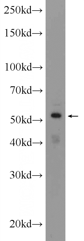 SKOV-3 cells were subjected to SDS PAGE followed by western blot with Catalog No:116948(ZNF140 Antibody) at dilution of 1:1000