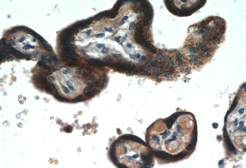 Immunohistochemistry of paraffin-embedded human placenta tissue slide using Catalog No:108646(C11orf83 Antibody) at dilution of 1:50 (under 40x lens)