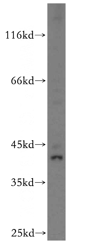 HEK-293 cells were subjected to SDS PAGE followed by western blot with Catalog No:112083(KLF6 antibody) at dilution of 1:800