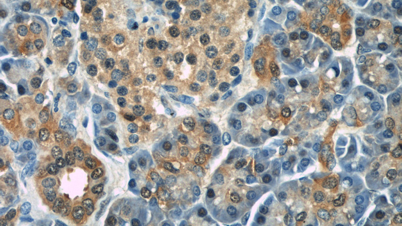 Immunohistochemical of paraffin-embedded human pancreas using Catalog No:114559(RBP1 antibody) at dilution of 1:50 (under 40x lens)