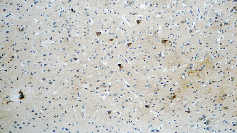 Immunohistochemistry of paraffin-embedded human brain tissue slide using Catalog No:114692(RERG Antibody) at dilution of 1:50 (under 10x lens)