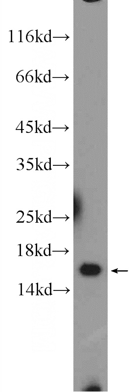 mouse heart tissue were subjected to SDS PAGE followed by western blot with Catalog No:114891(RPL35 Antibody) at dilution of 1:300