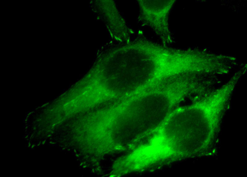 Immunofluorescent analysis of HepG2 cells, using VASP antibody Catalog No:116719 at 1:50 dilution and FITC-labeled donkey anti-rabbit IgG(green).