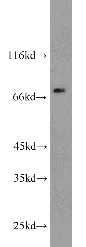 mouse thymus tissue were subjected to SDS PAGE followed by western blot with Catalog No:110068(DPP3 antibody) at dilution of 1:1500