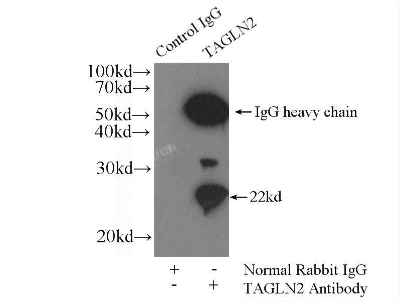 IP Result of anti-TAGLN2 (IP:Catalog No:107639, 4ug; Detection:Catalog No:107639 1:1000) with HEK-293 cells lysate 1000ug.