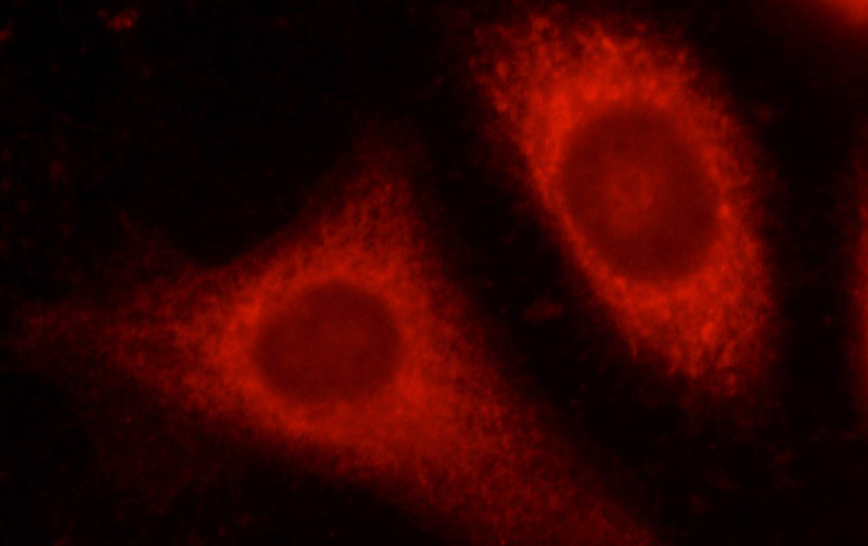 Immunofluorescent analysis of MCF-7 cells, using ALDH1B1 antibody Catalog No:107962 at 1:50 dilution and Rhodamine-labeled goat anti-rabbit IgG (red).