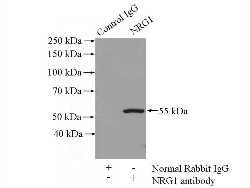 IP Result of anti-NRG1 (IP:Catalog No:113278, 4ug; Detection:Catalog No:113278 1:1000) with mouse liver tissue lysate 4000ug.