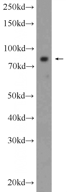 human testis tissue were subjected to SDS PAGE followed by western blot with Catalog No:107933(AKAP4 Antibody) at dilution of 1:1500