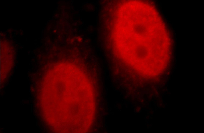 Immunofluorescent analysis of HepG2 cells, using H2AFX antibody Catalog No:111404 at 1:25 dilution and Rhodamine-labeled goat anti-rabbit IgG (red).