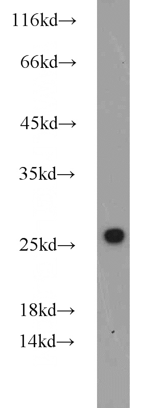 HEK-293 cells were subjected to SDS PAGE followed by western blot with Catalog No:108943(CBX1 antibody) at dilution of 1:1000