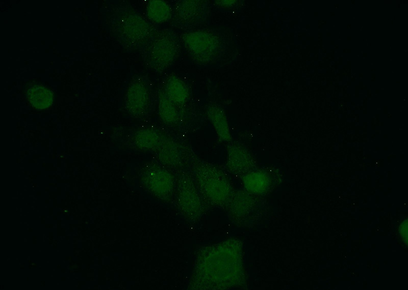 Immunofluorescent analysis of A431 cells using Catalog No:112368(MAD2L1BP Antibody) at dilution of 1:50 and Alexa Fluor 488-congugated AffiniPure Goat Anti-Rabbit IgG(H+L)