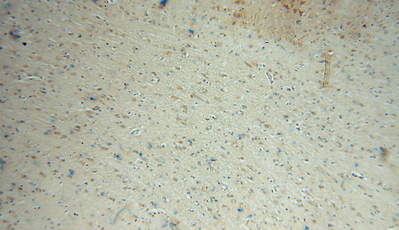 Immunohistochemical of paraffin-embedded human brain using Catalog No:111210(GRIPAP1 antibody) at dilution of 1:50 (under 10x lens)