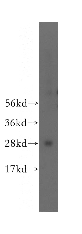 human lung tissue were subjected to SDS PAGE followed by western blot with Catalog No:112862(MRRF antibody) at dilution of 1:500
