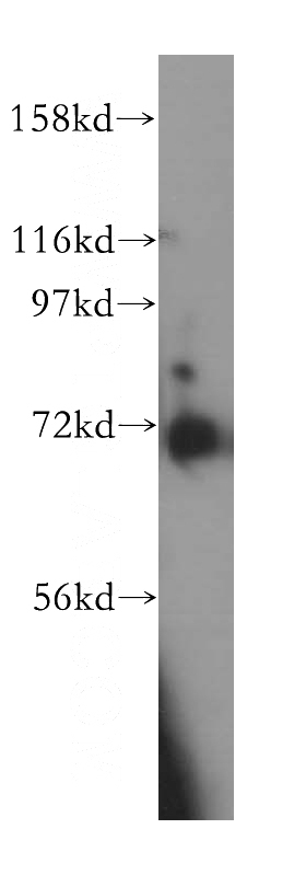 COLO 320 cells were subjected to SDS PAGE followed by western blot with Catalog No:111920(KBTBD2 antibody) at dilution of 1:500