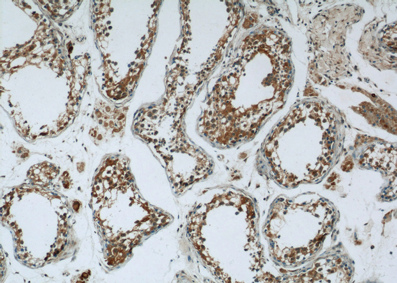 Immunohistochemistry of paraffin-embedded human testis tissue slide using Catalog No:108960(CCDC105 Antibody) at dilution of 1:50 (under 10x lens)