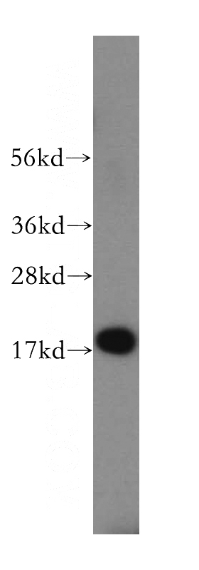 K-562 cells were subjected to SDS PAGE followed by western blot with Catalog No:115060(SAP18 antibody) at dilution of 1:500