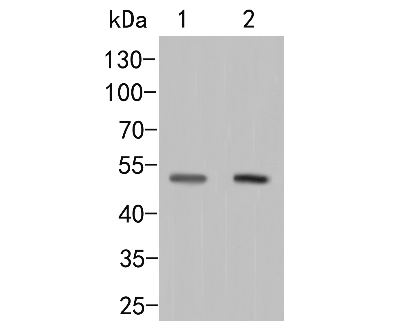 Fig1:; Western blot analysis of P2RX5 on different lysates. Proteins were transferred to a PVDF membrane and blocked with 5% BSA in PBS for 1 hour at room temperature. The primary antibody ( 1/1000) was used in 5% BSA at room temperature for 2 hours. Goat Anti-Rabbit IgG - HRP Secondary Antibody (HA1001) at 1:5,000 dilution was used for 1 hour at room temperature.; Positive control:; Lane 1: Rat brain tissue lysate; Lane 2: Rat heart tissue lysate