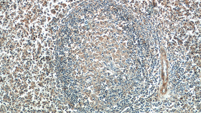 Immunohistochemistry of paraffin-embedded human spleen tissue slide using Catalog No:113773(PFKP Antibody) at dilution of 1:50 (under 10x lens)