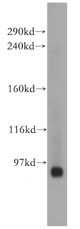 HeLa cells were subjected to SDS PAGE followed by western blot with Catalog No:110157(E2F8 antibody) at dilution of 1:1000