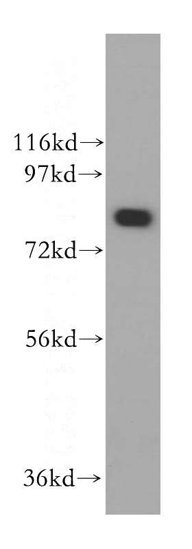 U-937 cells were subjected to SDS PAGE followed by western blot with Catalog No:110614(FEM1A antibody) at dilution of 1:300