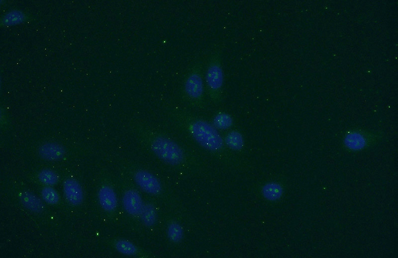 Immunofluorescent analysis of HepG2 cells using Catalog No:112123(KRI1 Antibody) at dilution of 1:50 and Alexa Fluor 488-congugated AffiniPure Goat Anti-Rabbit IgG(H+L)