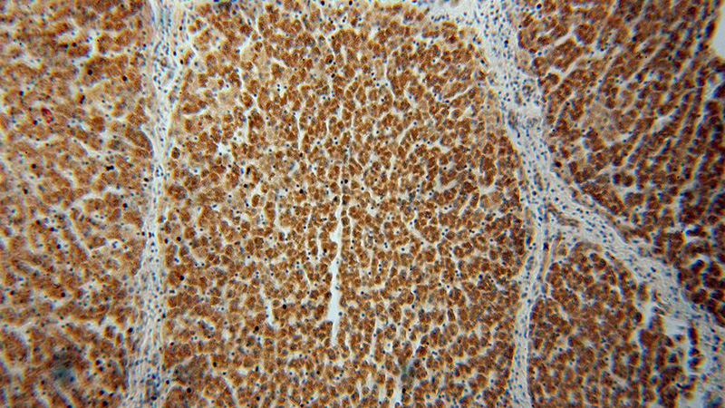 Immunohistochemical of paraffin-embedded human liver using Catalog No:108350(ATP5A1 antibody) at dilution of 1:100 (under 10x lens)