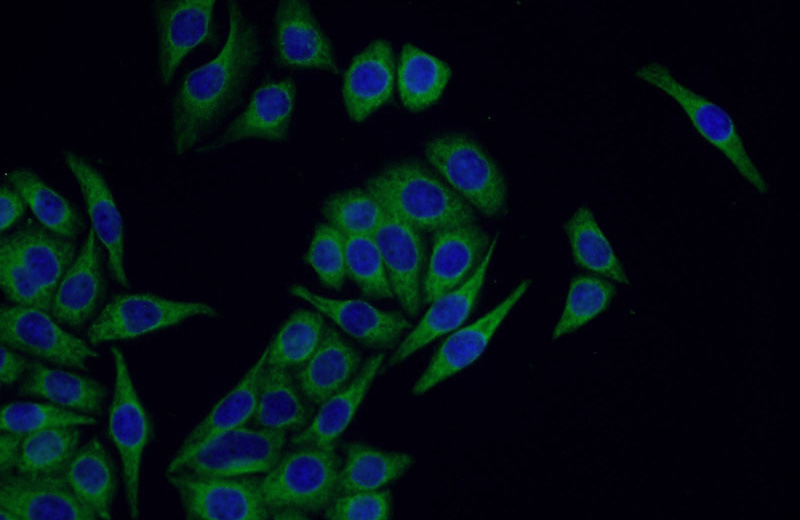 Immunofluorescent analysis of PC-3 cells using Catalog No:115519(SOX7 Antibody) at dilution of 1:50 and Alexa Fluor 488-congugated AffiniPure Goat Anti-Rabbit IgG(H+L)