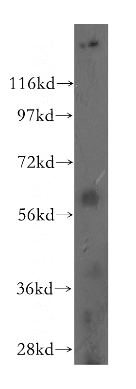 human liver tissue were subjected to SDS PAGE followed by western blot with Catalog No:114206(PRMT3 antibody) at dilution of 1:600