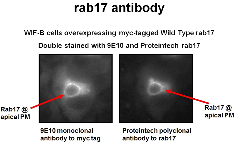 IF result of RAB17 antibody (Catalog No:111366) with WIF-B cells overexpressed myc-tagged RAB17 by A.C. Striz and Dr. P.L. Tuma.