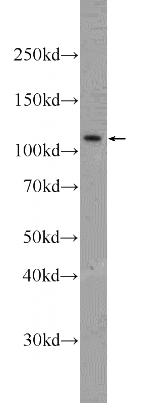 HepG2 cells were subjected to SDS PAGE followed by western blot with Catalog No:113005(MYT1L Antibody) at dilution of 1:600