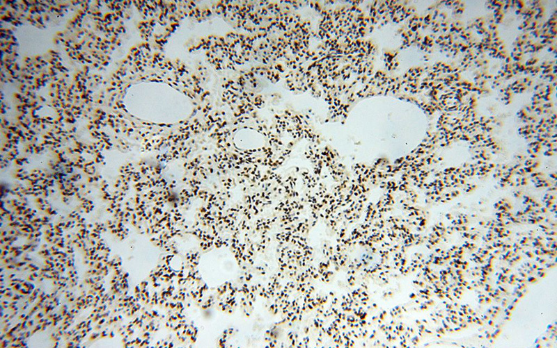 Immunohistochemical of paraffin-embedded human lung using Catalog No:115457(SNRPA1 antibody) at dilution of 1:100 (under 10x lens)