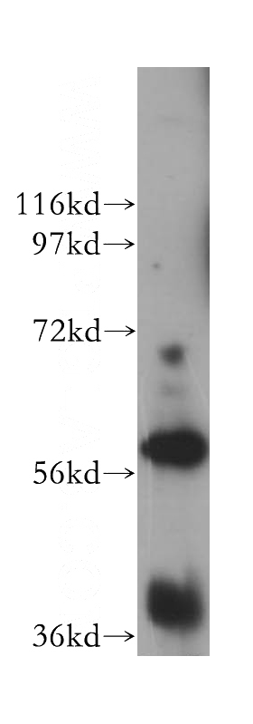 MCF7 cells were subjected to SDS PAGE followed by western blot with Catalog No:116695(UTP15 antibody) at dilution of 1:300