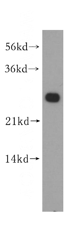 HeLa cells were subjected to SDS PAGE followed by western blot with Catalog No:112690(MMAB antibody) at dilution of 1:300