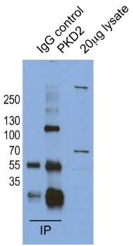 IP result of anti-PKD2 (Catalog No:114055 for IP and Detection) with HeLa cell lysate.