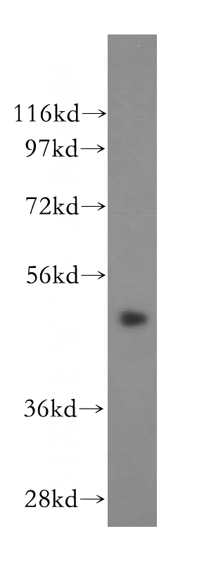 HeLa cells were subjected to SDS PAGE followed by western blot with Catalog No:109617(CSTF1 antibody) at dilution of 1:500