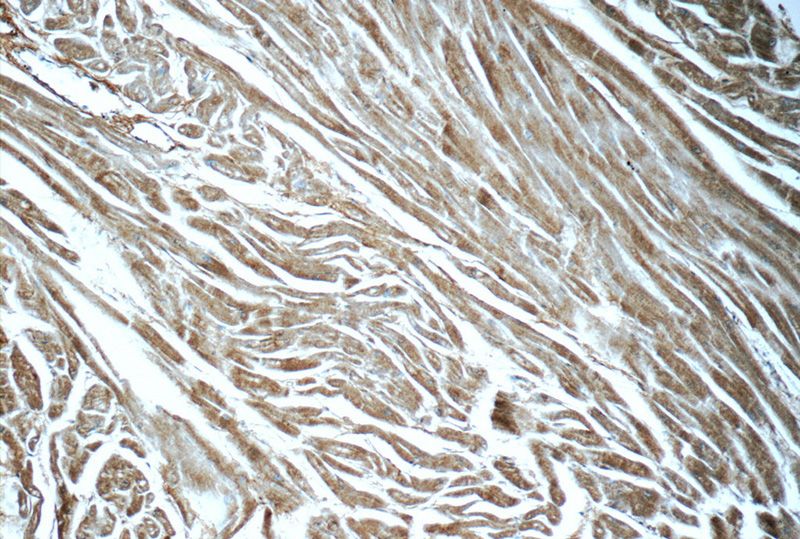 Immunohistochemistry of paraffin-embedded human heart tissue slide using Catalog No:108411(BAI2-Specific Antibody) at dilution of 1:50 (under 10x lens)