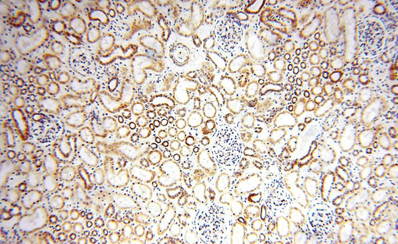 Immunohistochemical of paraffin-embedded human kidney using Catalog No:113071(NDUFB11 antibody) at dilution of 1:100 (under 10x lens)
